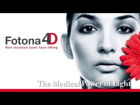 fotona 4d laser lift rejuvenation skin facelift surgery surgical non face
