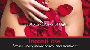 Vaginal Laser Tightening Incontinence Laser Clinic Brisbane