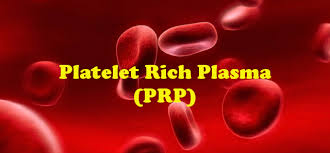 platelet rich plasma brisbane