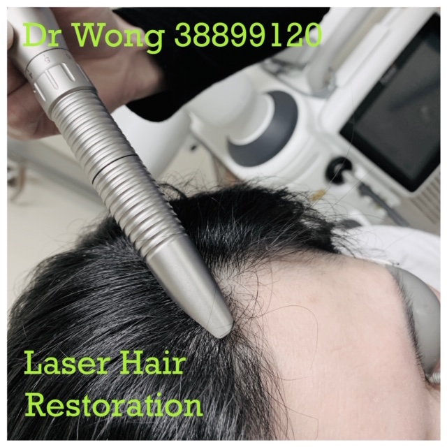 Laser Hair Restoration